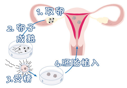 主案例